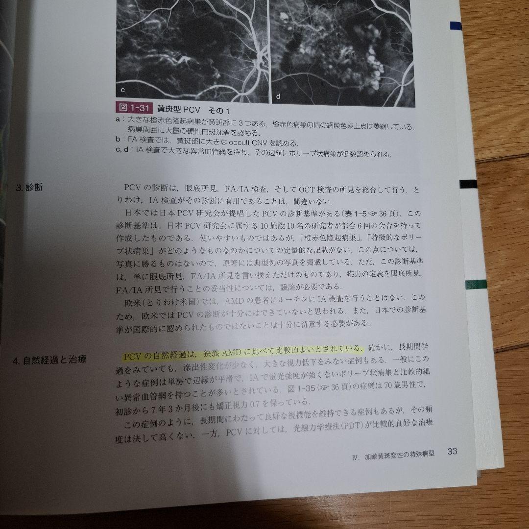 加齢黄斑変性