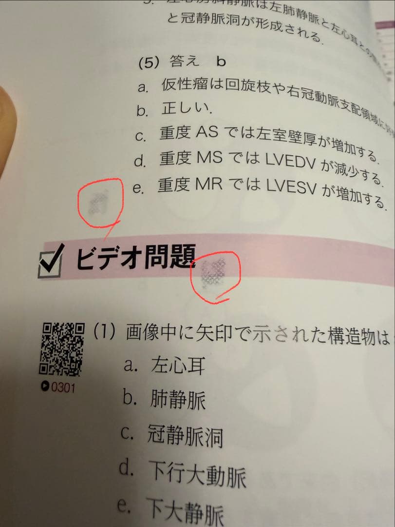 中外医学社 TEE試験対策ガイド JB POT 心エコー図専門医試験徹底攻略